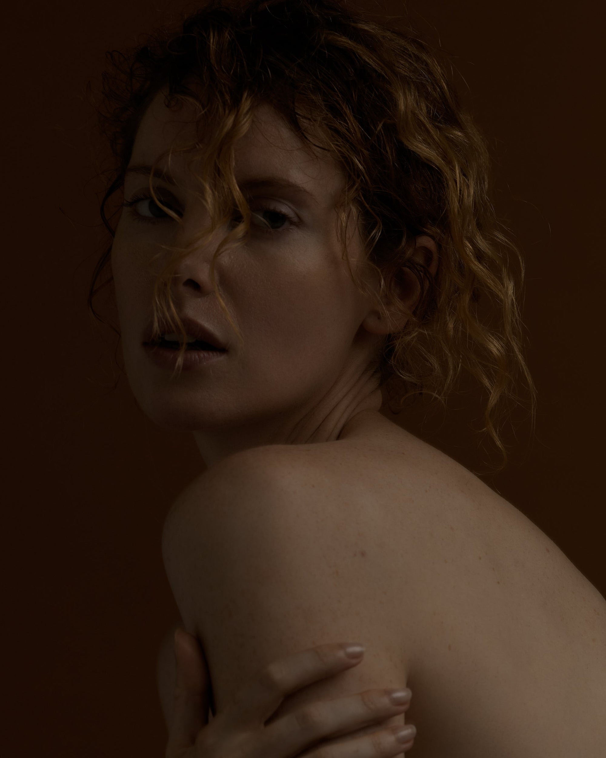 Understanding Pigmentation: Why Not All Discolouration Should Be Treated the Same Way